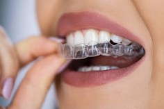 Ortodoncia Invisible Ortodoncia Invisible-invisalign