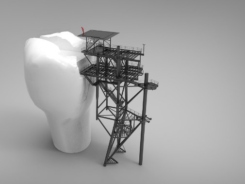 img reconstrucción dental